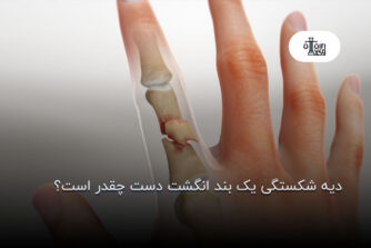 دیه شکستگی یک بند انگشت دست چقدر است؟