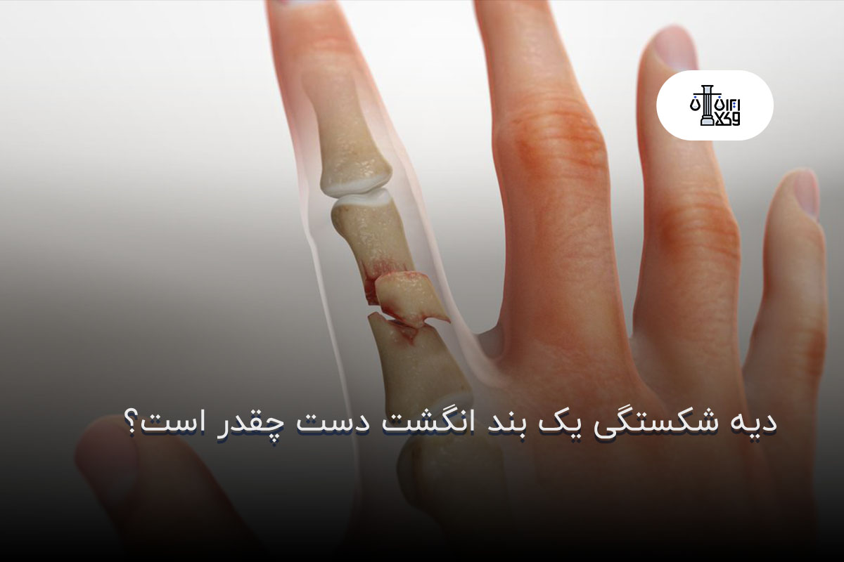 دیه شکستگی یک بند انگشت دست چقدر است؟